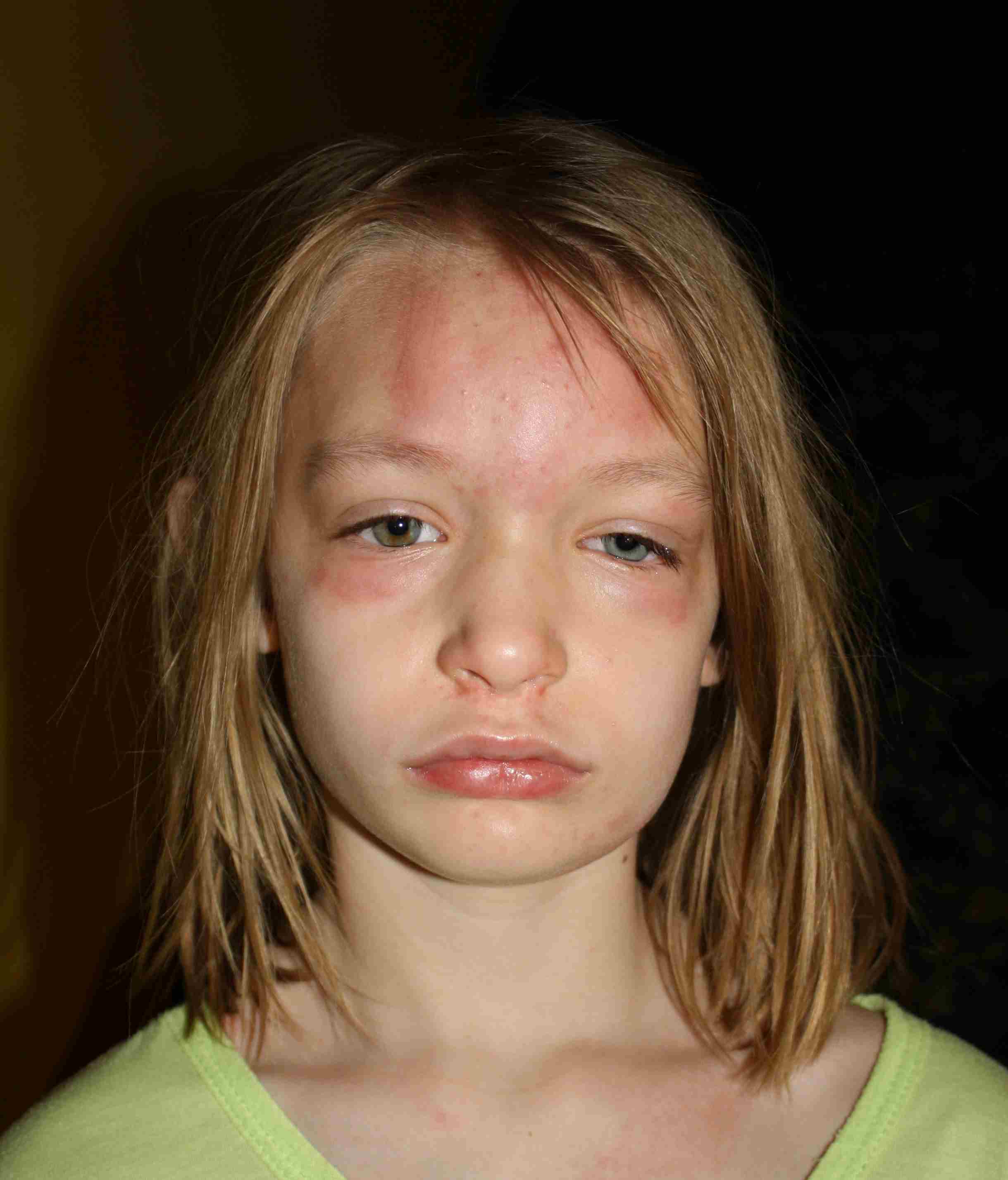 2012-03-29 Cate Say no to Pollen.jpg